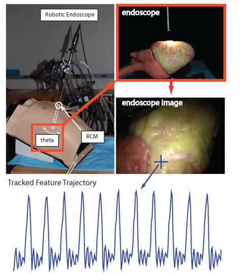 Image of a stereo laparoscope and heart phantom model