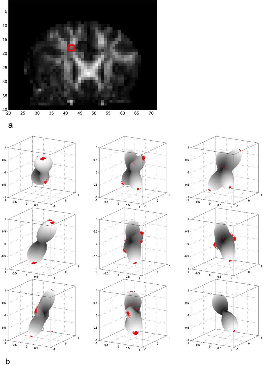Q-Ball Imaging using MR data