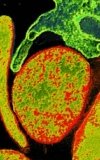 Contamination hits cell work